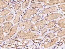 Invitrogen MRPL11 Polyclonal Antibody 100 &mu;L; Unconjugated:Antibodies,
