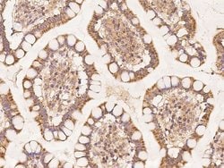 Invitrogen MRPL11 Polyclonal Antibody 100 &mu;L; Unconjugated:Antibodies,