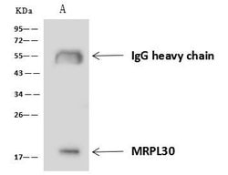 Invitrogen RM30 Polyclonal Antibody 100 &mu;L; Unconjugated:Antibodies,