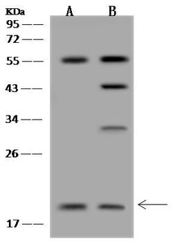 Invitrogen RM30 Polyclonal Antibody 100 &mu;L; Unconjugated:Antibodies,
