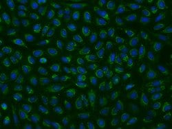 Invitrogen MRPL9 Polyclonal Antibody 100 &mu;L | Buy Online | Invitrogen&trade; | Fisher Scientific