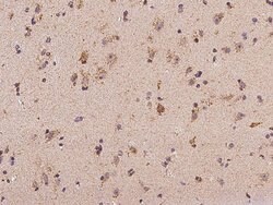 Invitrogen MRPL9 Polyclonal Antibody 100 &mu;L | Buy Online | Invitrogen&trade; | Fisher Scientific