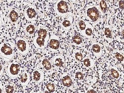 Invitrogen MRPL9 Polyclonal Antibody 100 &mu;L | Buy Online | Invitrogen&trade; | Fisher Scientific