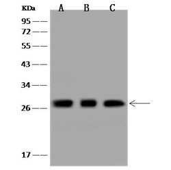 Invitrogen MRPL9 Polyclonal Antibody 100 &mu;L | Buy Online | Invitrogen&trade; | Fisher Scientific
