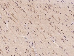 Invitrogen MRPS22 Polyclonal Antibody 100 &mu;L; Unconjugated:Antibodies,