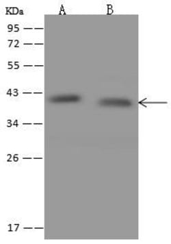 Invitrogen MRPS22 Polyclonal Antibody 100 &mu;L; Unconjugated:Antibodies,