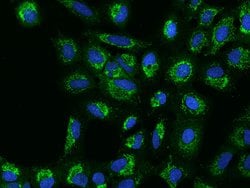 Invitrogen MRPS5 Polyclonal Antibody 100 &mu;L; Unconjugated:Antibodies,