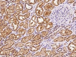 Invitrogen MRPS5 Polyclonal Antibody 100 &mu;L; Unconjugated:Antibodies,