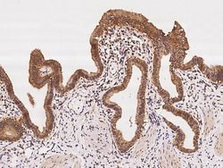 Invitrogen MRPS5 Polyclonal Antibody 100 &mu;L; Unconjugated:Antibodies,