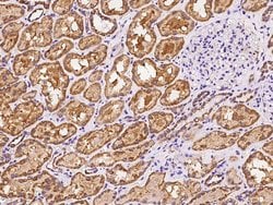 Invitrogen MRPS5 Polyclonal Antibody 100 &mu;L; Unconjugated:Antibodies,