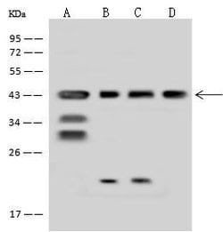 Invitrogen MRPS5 Polyclonal Antibody 100 &mu;L; Unconjugated:Antibodies,