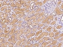 Invitrogen MTHFS Polyclonal Antibody 100 &mu;L; Unconjugated:Antibodies,