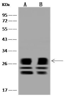 Invitrogen MTHFS Polyclonal Antibody 100 &mu;L; Unconjugated:Antibodies,