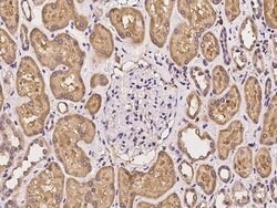 Invitrogen MTRR Polyclonal Antibody 100 &mu;L; Unconjugated:Antibodies,
