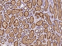 Invitrogen NARS2 Polyclonal Antibody 100 &mu;L; Unconjugated:Antibodies,