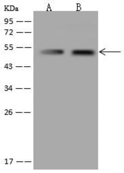 Invitrogen NARS2 Polyclonal Antibody 100 &mu;L; Unconjugated:Antibodies,