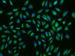 Invitrogen NDUFB8 Polyclonal Antibody 100 &mu;L; Unconjugated:Antibodies,