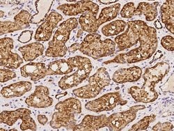 Invitrogen NDUFB8 Polyclonal Antibody 100 &mu;L; Unconjugated:Antibodies,