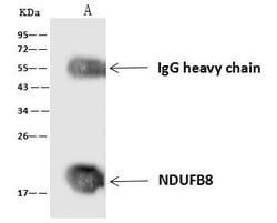 Invitrogen NDUFB8 Polyclonal Antibody 100 &mu;L; Unconjugated:Antibodies,