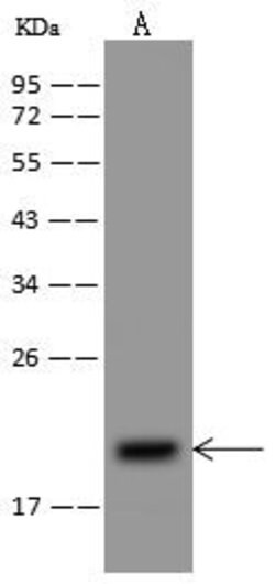 Invitrogen NDUFB8 Polyclonal Antibody 100 &mu;L; Unconjugated:Antibodies,