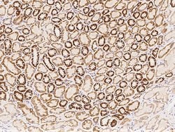Invitrogen NDUFS5 Polyclonal Antibody 100 &mu;L; Unconjugated:Antibodies,