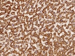 Invitrogen NDUFS5 Polyclonal Antibody 100 &mu;L; Unconjugated:Antibodies,