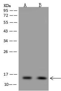 Invitrogen NDUFS5 Polyclonal Antibody 100 &mu;L; Unconjugated:Antibodies,