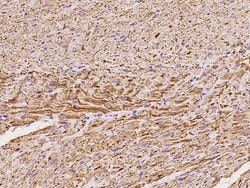 Invitrogen NDUFV2 Polyclonal Antibody 100 &mu;L | Buy Online | Invitrogen&trade; | Fisher Scientific