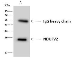 Invitrogen NDUFV2 Polyclonal Antibody 100 &mu;L | Buy Online | Invitrogen&trade; | Fisher Scientific