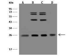 Invitrogen NDUFV2 Polyclonal Antibody 100 &mu;L | Buy Online | Invitrogen&trade; | Fisher Scientific