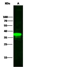 Invitrogen IkB alpha Polyclonal Antibody 100 μL; Unconjugated:Antibodies,