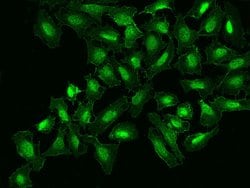 Invitrogen NOTCH2 Polyclonal Antibody 100 &mu;L; Unconjugated:Antibodies,