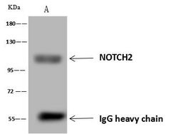 Invitrogen NOTCH2 Polyclonal Antibody 100 &mu;L; Unconjugated:Antibodies,
