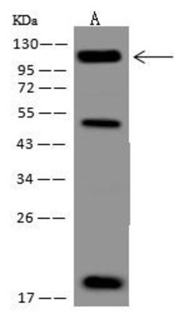 Invitrogen NOTCH2 Polyclonal Antibody 100 &mu;L; Unconjugated:Antibodies,