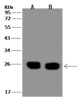 Invitrogen NTMT1 Polyclonal Antibody 100 μL; Unconjugated:Antibodies,