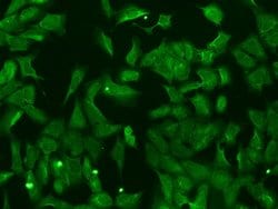 Invitrogen NUDT11 Polyclonal Antibody 100 &mu;L; Unconjugated:Antibodies,