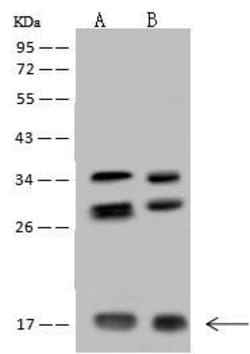 Invitrogen NUDT11 Polyclonal Antibody 100 &mu;L; Unconjugated:Antibodies,