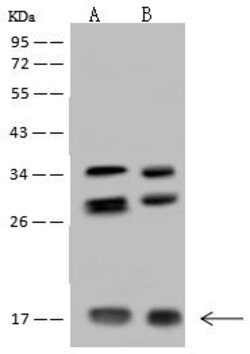 Invitrogen NUDT11 Polyclonal Antibody 100 &mu;L; Unconjugated:Antibodies,