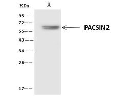 Invitrogen PACSIN2 Polyclonal Antibody 100 &mu;L; Unconjugated:Antibodies,