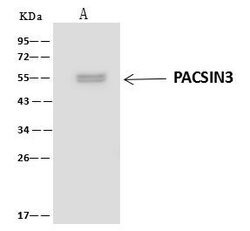 Invitrogen PACSIN3 Polyclonal Antibody 100 &mu;L; Unconjugated:Antibodies,