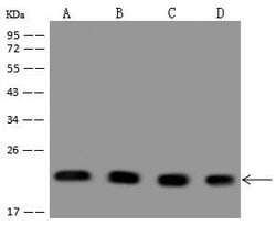 Invitrogen PARK7 Polyclonal Antibody 100 &mu;L; Unconjugated:Antibodies,