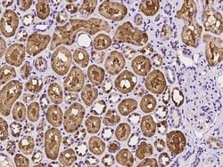 Invitrogen PCK1 Polyclonal Antibody 100 &mu;L; Unconjugated:Antibodies,