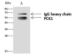 Invitrogen PCK1 Polyclonal Antibody 100 &mu;L; Unconjugated:Antibodies,