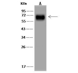 Invitrogen PCK1 Polyclonal Antibody 100 &mu;L; Unconjugated:Antibodies,