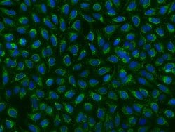 Invitrogen PDHX Polyclonal Antibody 100 &mu;L | Buy Online | Invitrogen&trade; | Fisher Scientific