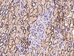 Invitrogen PDHX Polyclonal Antibody 100 &mu;L | Buy Online | Invitrogen&trade; | Fisher Scientific