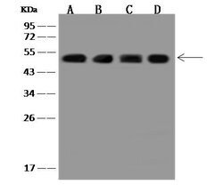 Invitrogen PDHX Polyclonal Antibody 100 &mu;L | Buy Online | Invitrogen&trade; | Fisher Scientific