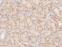 Invitrogen PDSS2 Polyclonal Antibody 100 &mu;L; Unconjugated:Antibodies,