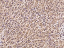 Invitrogen PDSS2 Polyclonal Antibody 100 &mu;L; Unconjugated:Antibodies,