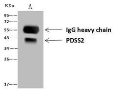 Invitrogen PDSS2 Polyclonal Antibody 100 &mu;L; Unconjugated:Antibodies,